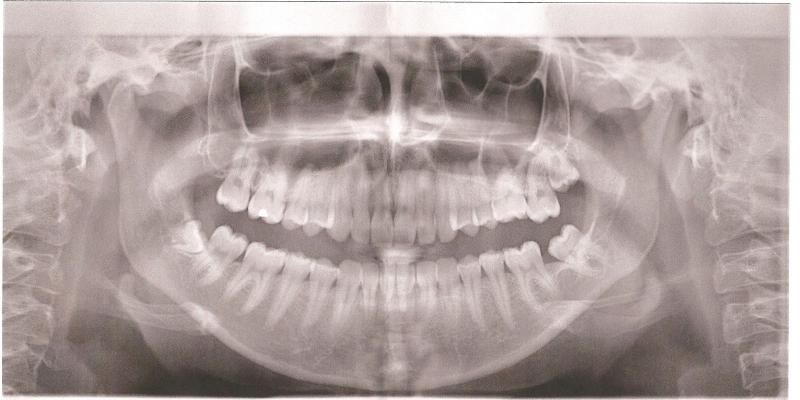 Image: dent-de-sag-881ff5.jpg